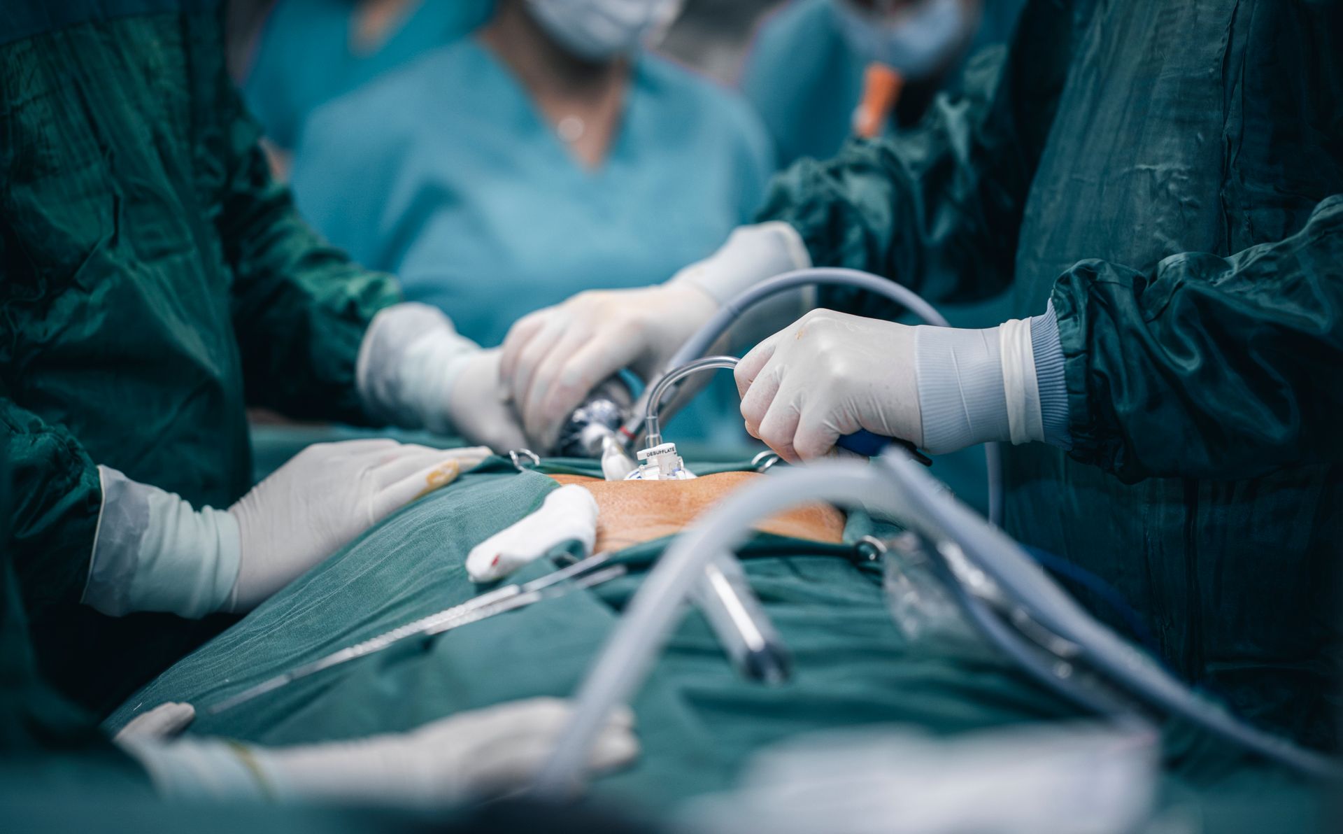 Single Port Robotic Surgery - minimally invasive keyhole surgery ports placed through the abdominal wall