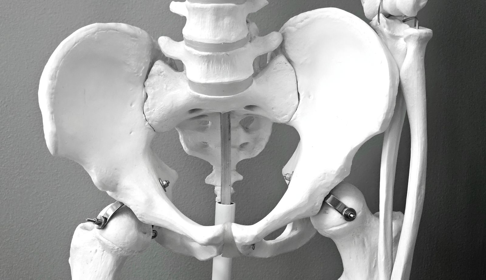 Single Port Robotic Surgery - anatomical model of the pelvis