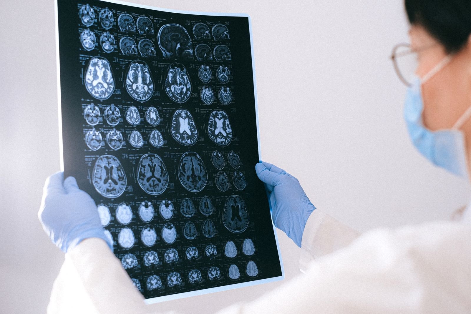 Single Port Robotic Surgery - specialist reviewing MRI images before recommending a robotic system