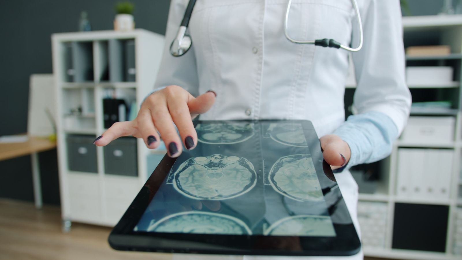 Single Port Robotic Surgery - doctor reviewing scan images on a tablet